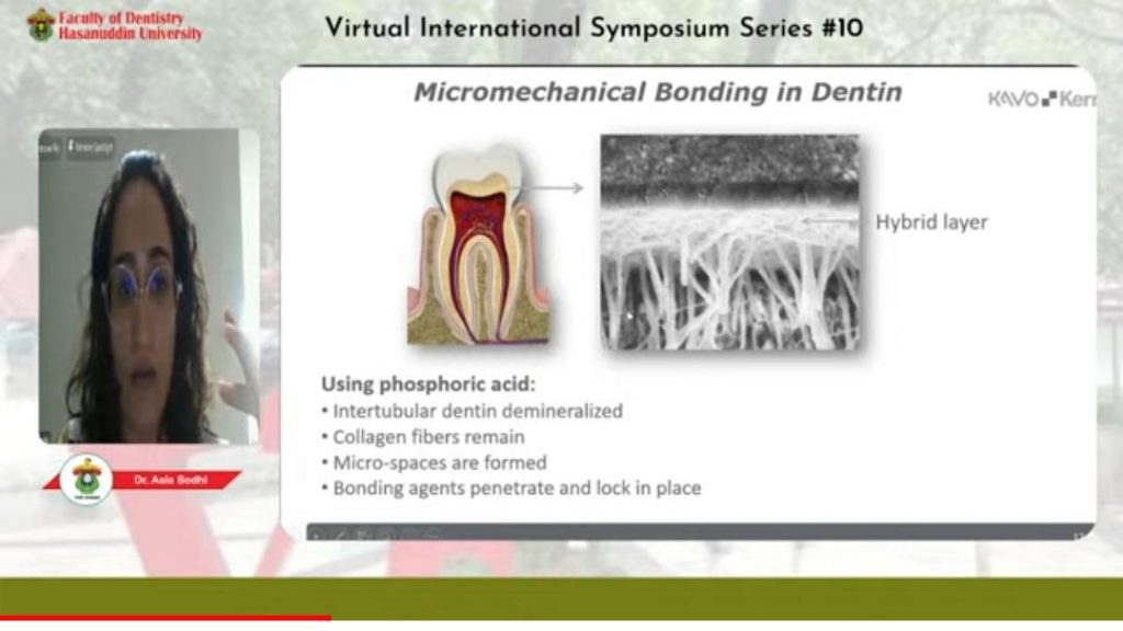 FKG Unhas Gelar Virtual Internasional Symposium Hadirkan Narasumber dari Singapura