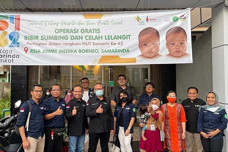 FKG Unhas Lakukan Operasi Bibir Sumbing Gratis di Samarinda