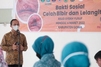 FKG Unhas Selenggarakan Operasi Bibir Sumbing Gratis di Kabupaten Gowa