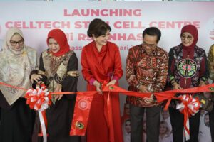 Tidak Perlu ke Jakarta, Layanan Stem Cell Kini Hadir di RS Unhas
