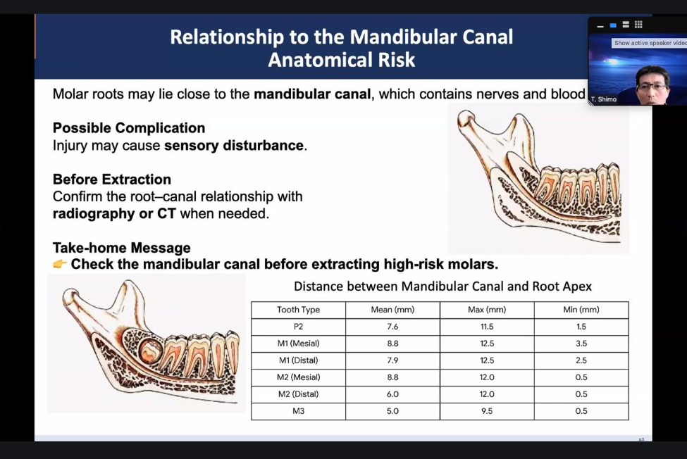 Slide on mandibular canal anatomical risk