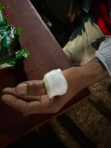 Tangan seseorang Tengah Malam Pascagempa, KKN Tematik Bencana Unhas Bergerak Tangani Warga dengan Luka Berat